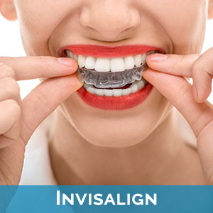 32084 Invisalign